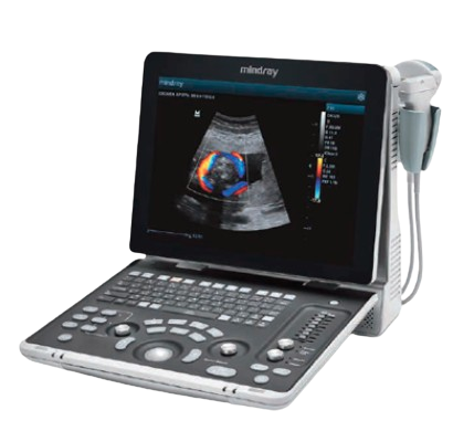 monitor de ultrassom