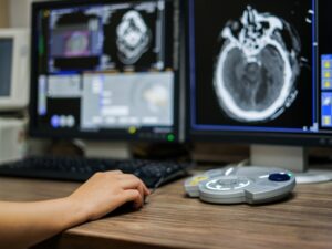 otimizar o desempenho do sistema RIS