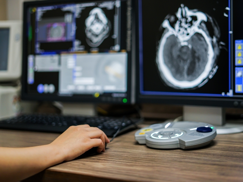 otimizar o desempenho do sistema RIS